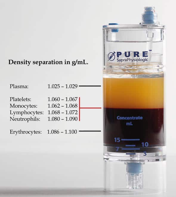 PurePRP® SupraPhysiologic PRP centrifuge kit density separation in g/ML